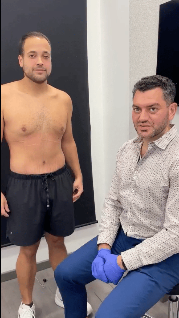 Jonathan's skin removal transformation at Elevé Cosmetic Surgery