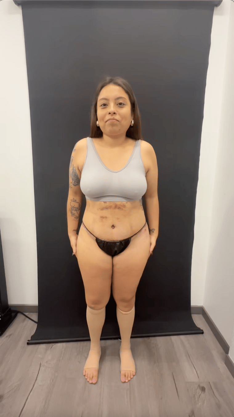 Level Up Tuck patient testimonial thumbnail