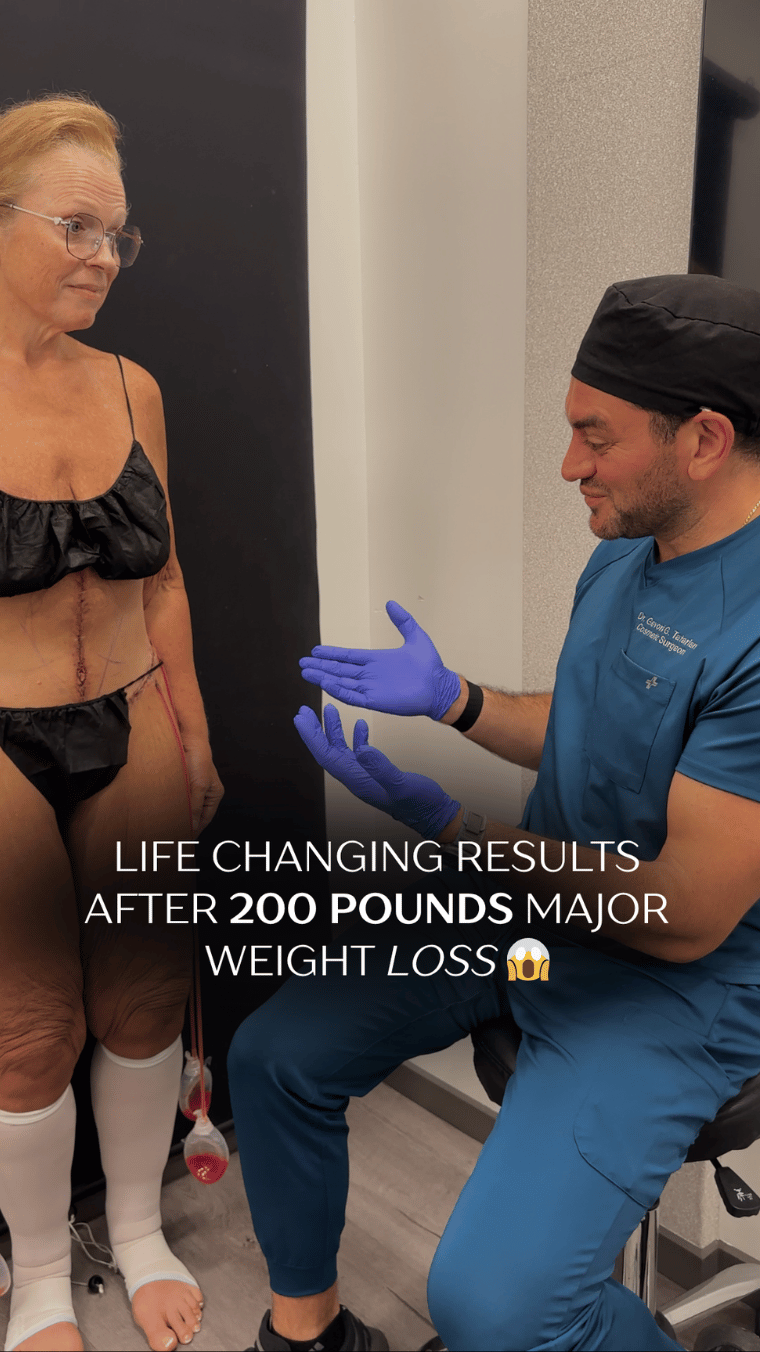 Level Up Tuck patient testimonial thumbnail